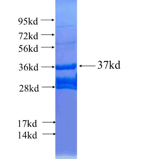 Recombinant human CRH SDS-PAGE