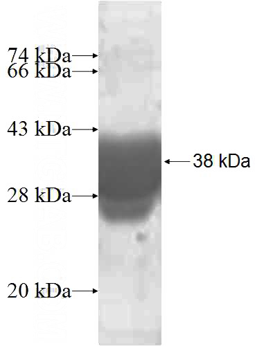 Recombinant Human ENY2 SDS-PAGE
