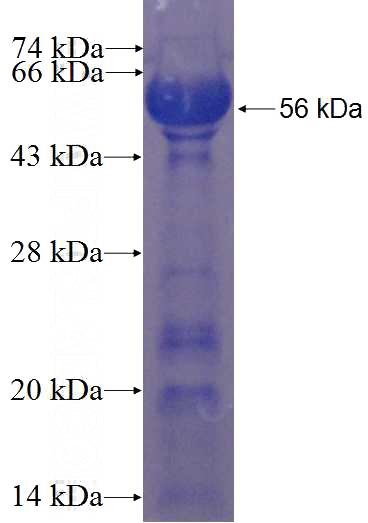 Recombinant Human C15orf27 SDS-PAGE