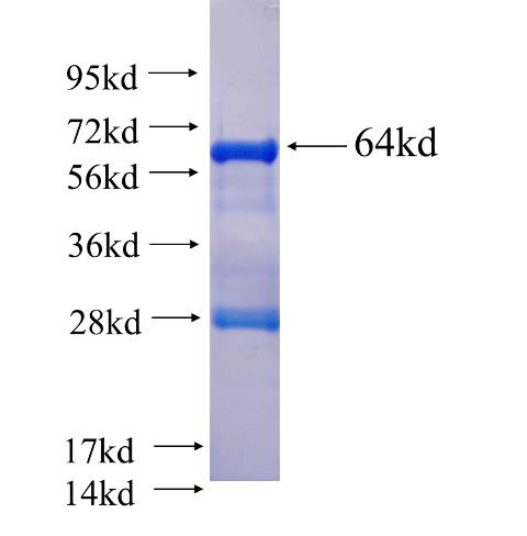 Recombinant human LAMB3 SDS-PAGE