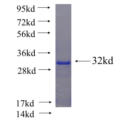 Recombinant human SLC6A15 SDS-PAGE