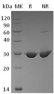 Human PSPH (His tag) recombinant protein