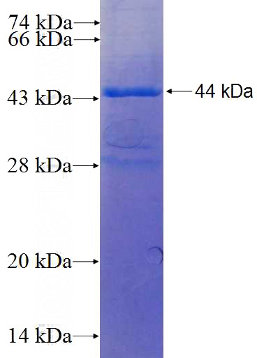 Recombinant Human SFRP2 SDS-PAGE