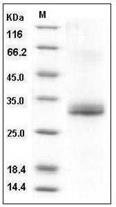 Human Noggin / NOG Protein (His Tag) SDS-PAGE