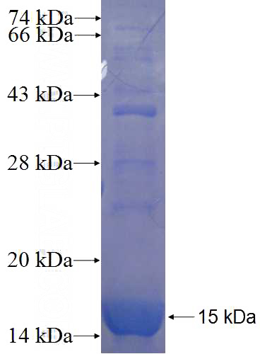 Recombinant Human KIF26A SDS-PAGE