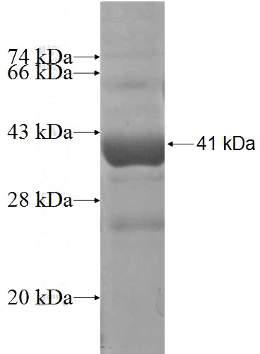 Recombinant Human SNX16 SDS-PAGE