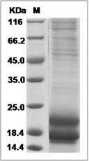 Human CALCA / CGRP Protein (His Tag)