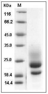 Human CD83 / HB15 Protein (His Tag) SDS-PAGE