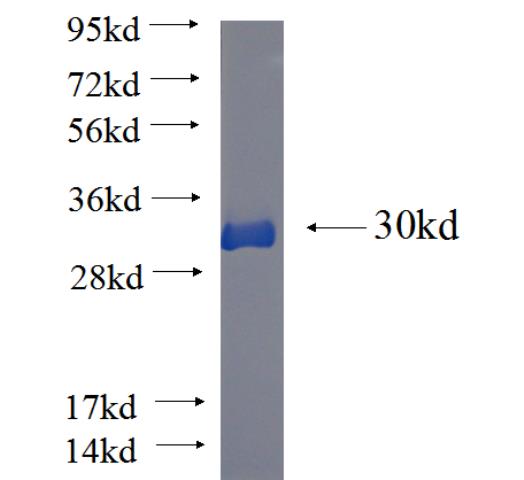 Recombinant human KIF5C SDS-PAGE
