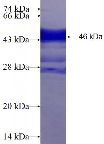 Recombinant Human ETV1 SDS-PAGE