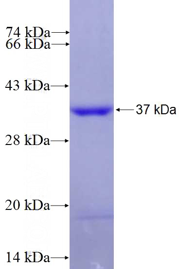 Recombinant Human RPUSD4 SDS-PAGE