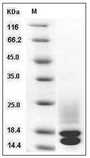 Mouse Cystatin C / CST3 Protein (His Tag) SDS-PAGE