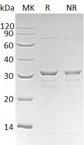Human CLIC1/G6/NCC27 (His tag) recombinant protein