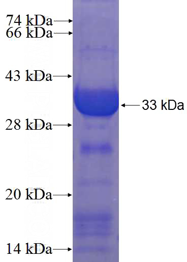 Recombinant Human THAP5 SDS-PAGE