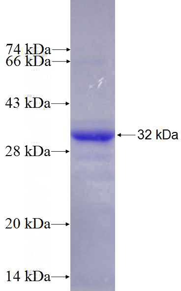 Recombinant Human SERTAD1 SDS-PAGE