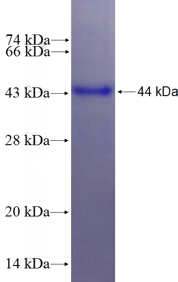 Recombinant Human KIF22 SDS-PAGE