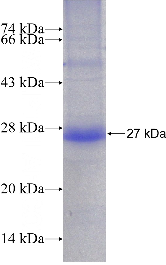 Recombinant Human SLC39A14 SDS-PAGE
