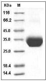 Human Layilin / LAYN Protein (His Tag) SDS-PAGE