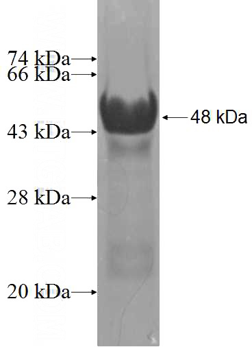 Recombinant Human RRP15 SDS-PAGE