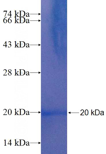 Recombinant Human BTF3L4 SDS-PAGE
