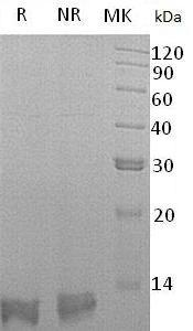 Human SPINK4 (His tag) recombinant protein