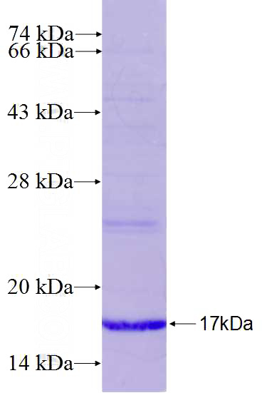 Recombinant Human PLCB2 SDS-PAGE