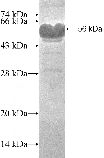 Recombinant Human ZFY SDS-PAGE