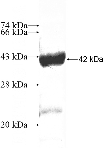 Recombinant Human CSGLCA-T SDS-PAGE