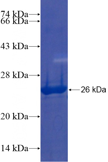 Recombinant Human RNF145 SDS-PAGE
