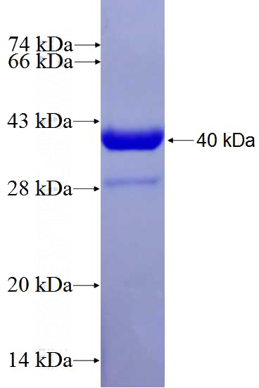 Recombinant Human FADS2-Specific SDS-PAGE