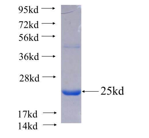Recombinant human HAPLN4 SDS-PAGE