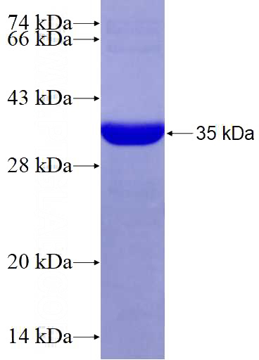 Recombinant Human FCHSD2 SDS-PAGE