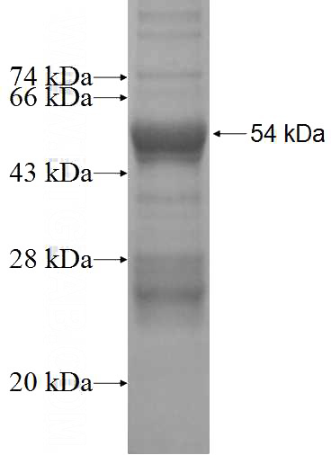 Recombinant Human RAB34 SDS-PAGE