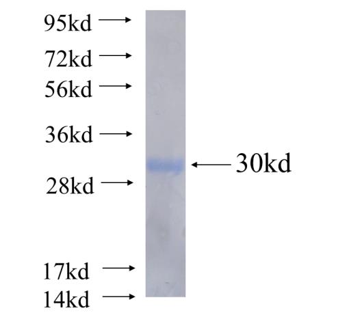 Recombinant human PEX5 SDS-PAGE