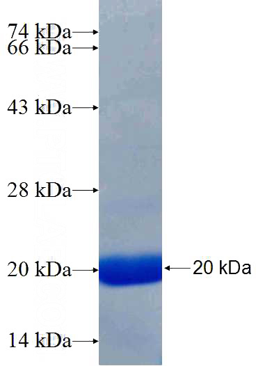 Recombinant Human PLCG2 SDS-PAGE