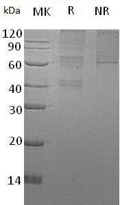 Human GPC5 (His tag) recombinant protein