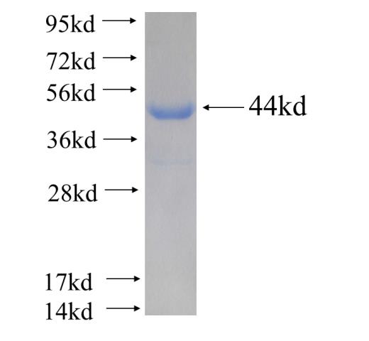Recombinant human CBS SDS-PAGE