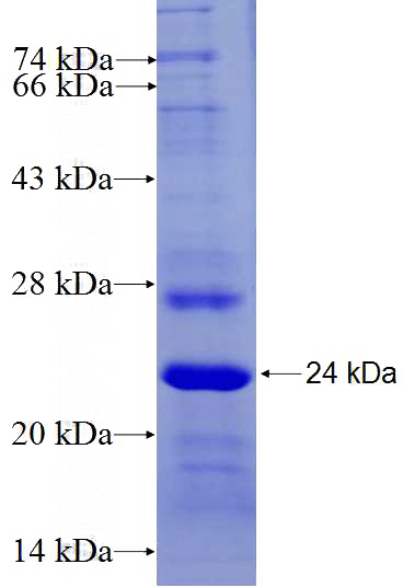 Recombinant Human TMEM146 SDS-PAGE