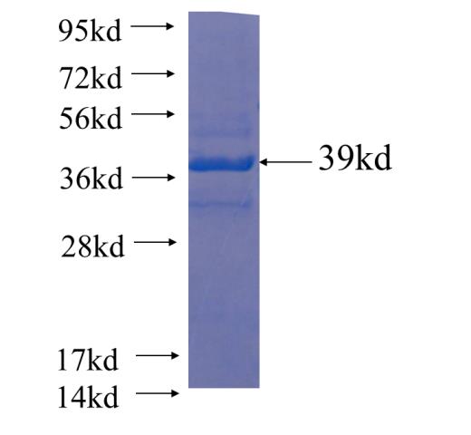Recombinant human HBG1 SDS-PAGE