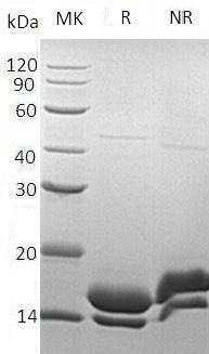 Human PI3/WAP3/WFDC14 (His tag) recombinant protein