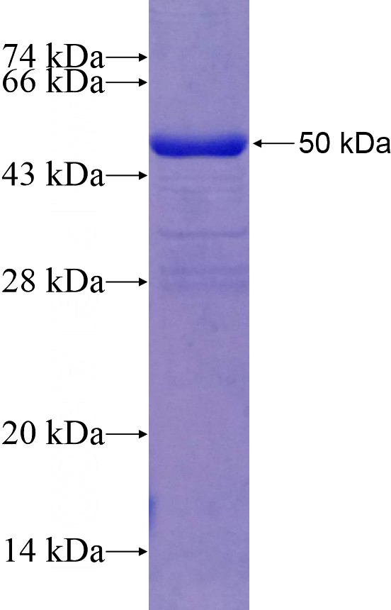 Recombinant Human PP2A SDS-PAGE