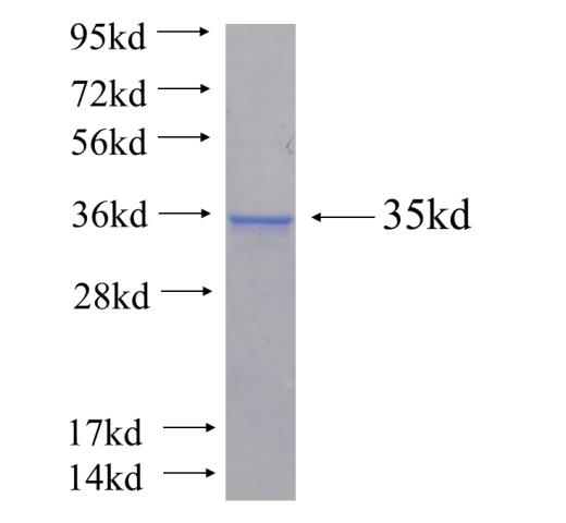 Recombinant human FIBIN SDS-PAGE