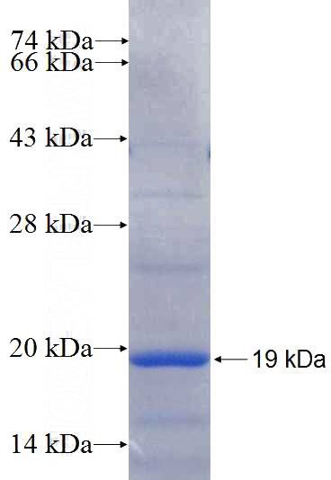 Recombinant Human PPP1R3B SDS-PAGE