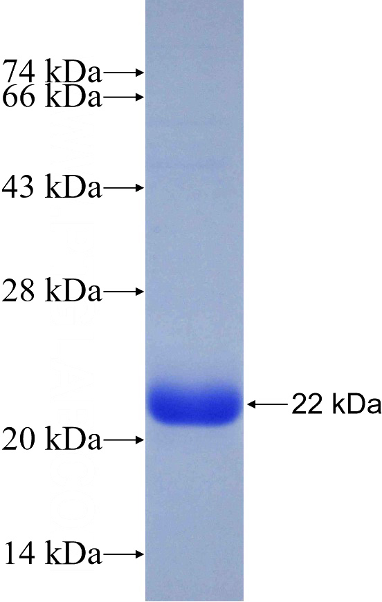 Recombinant Human DNAH8 SDS-PAGE
