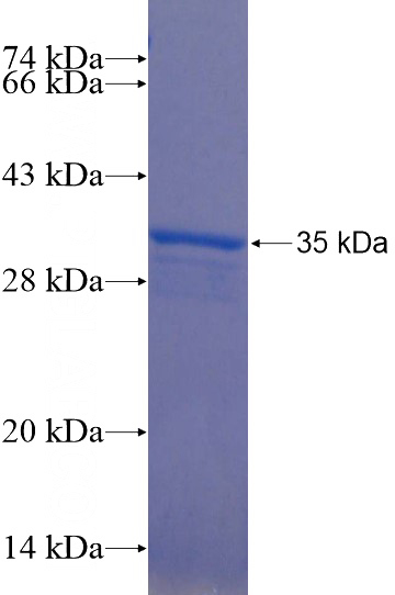 Recombinant Human KCTD16 SDS-PAGE