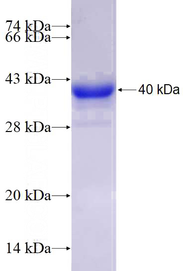 Recombinant Human RABGGTB SDS-PAGE