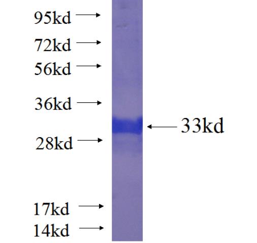 Recombinant human ZNF331 SDS-PAGE