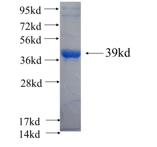 Recombinant human PI4KA SDS-PAGE