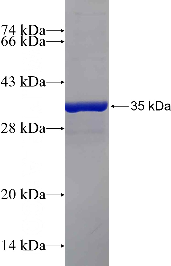 Recombinant Human PVRIG SDS-PAGE