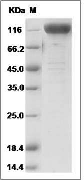 Mouse Nicastrin / NCSTN Protein (Fc Tag) SDS-PAGE